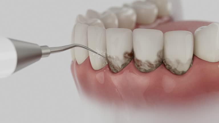 Trusted Tooth Extraction service in Cape Charles, VA - Dentist Open Now